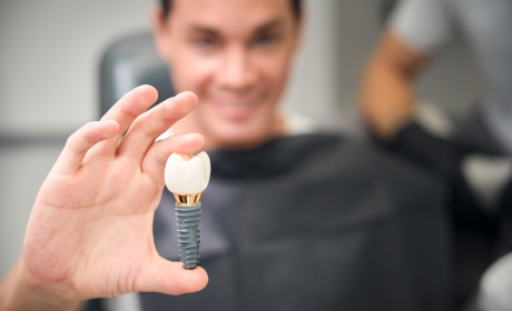 Dental Implants in Southam — Your Options Explained