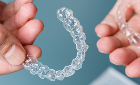Invisalign in Southam: What’s Really Included, How Long It Takes, and Why the Price Matters