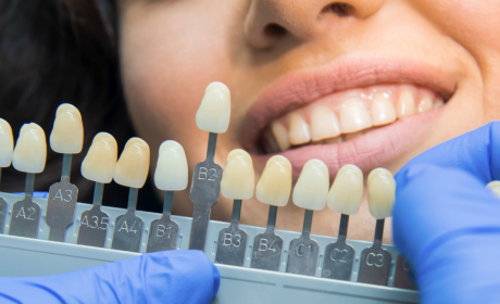 Teeth Whitening at Everwell — Safe, Dentist-Led Results in Southam
